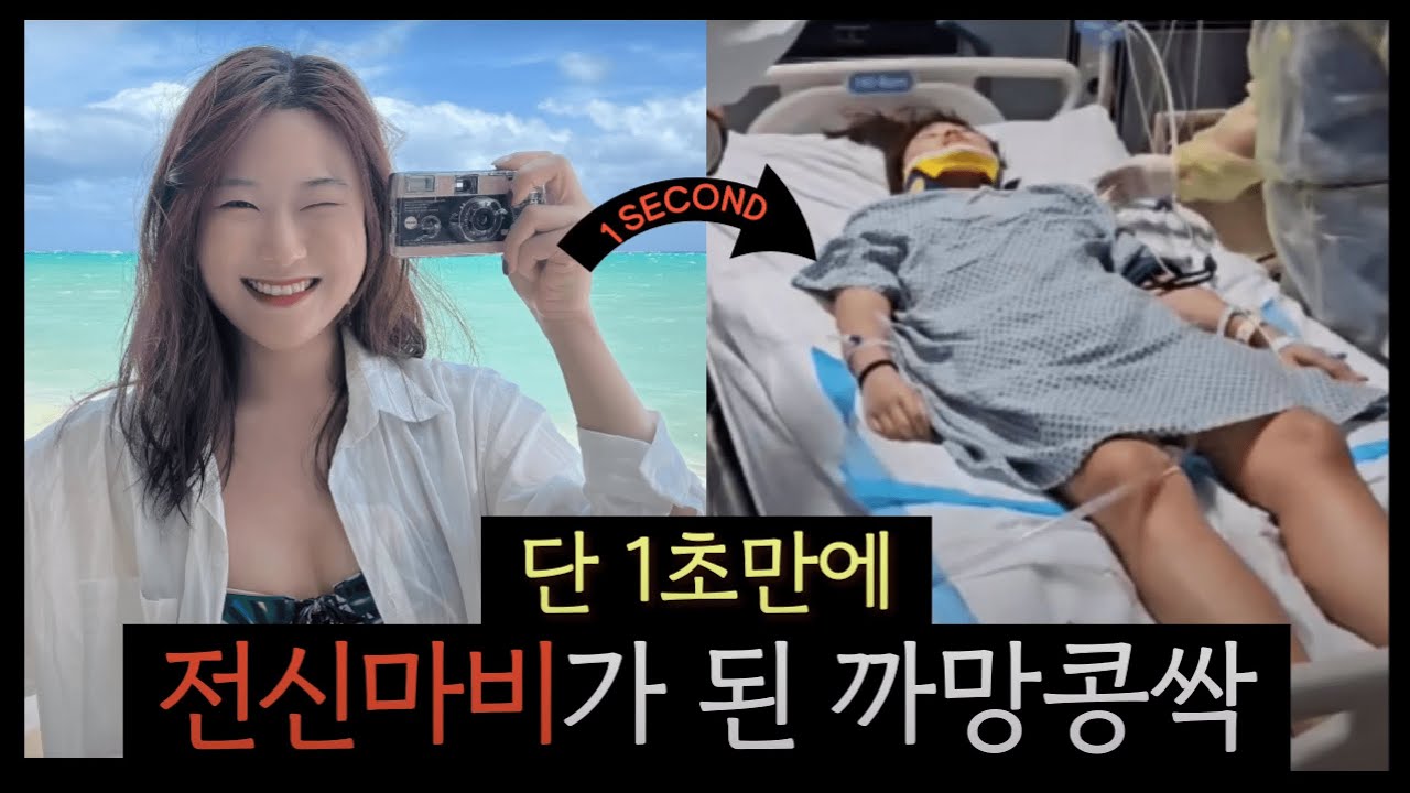 [2024년도 해외에서 겪은 사건사고 경험담 공모전] 영상 부문 대상 : 단 1초만에 전신마비가 된 까망콩싹 이미지